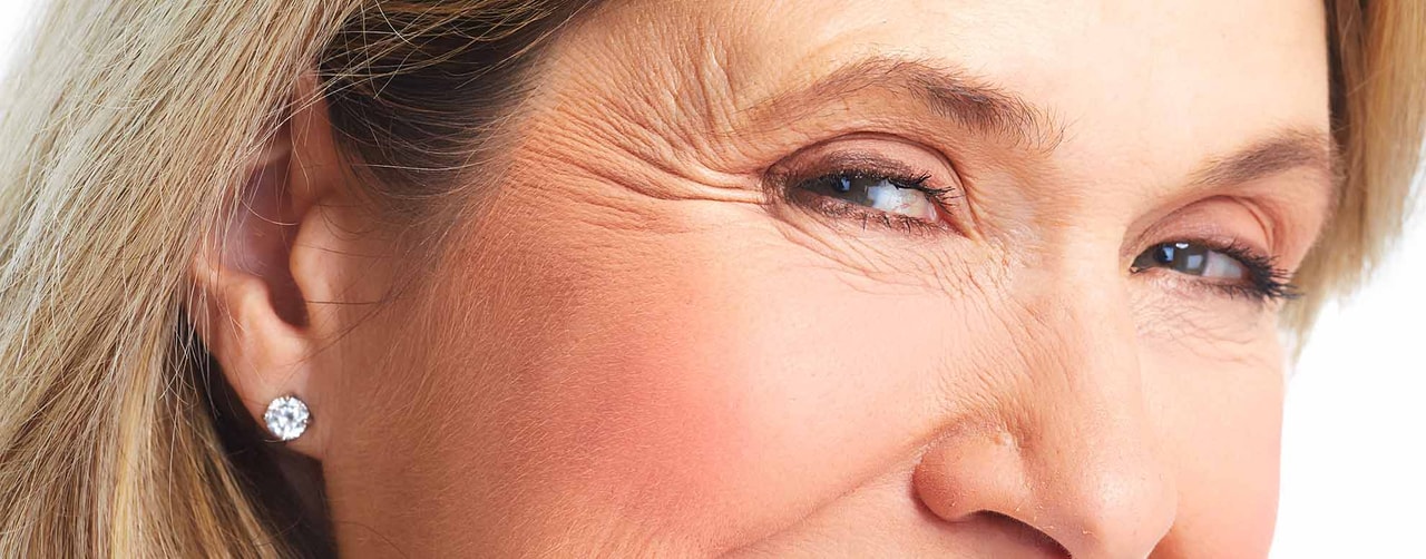 Treatment for forehead lines and droopy brows